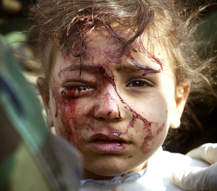 Một bé gái người Iraq bị thương được lính thủy đánh bộ Mỹ chăm sóc ở miền Trung Iraq ngày 29/3/2003. Đứa bé khi đó 4 tuổi, được phát hiện khi mắt dính đầy máu do chấn thương. Cô bé này đang gào khóc vì mẹ em bị chết còn bố em bị bắn vào chân. Bố em đã bị lính Mỹ còng tay và lúc đó người đàn ông đã cầu xin lính Mỹ thả ra để ông có thể ôm đứa con gái nhỏ đang hoảng sợ.